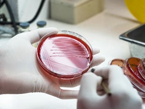 Antimicrobial agents for oral diseases