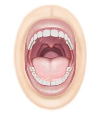 Dental