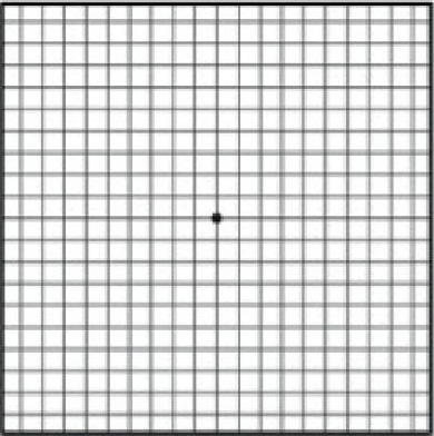 AMD Amsler Grid Chart - Age-related Macular Degeneration - Conditions and Treatments SingHealth 