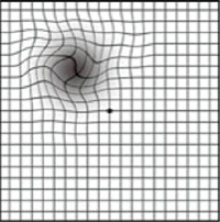 Vision impaired by Age-related Macular Degeneration (AMD) Amsler Grid