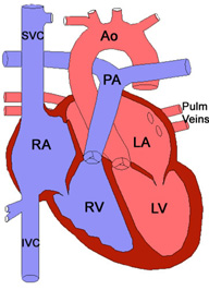 The chambers of the heart and connecting blood vessels are labeled - KKH