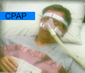 CPAP - Singapore General Hospital