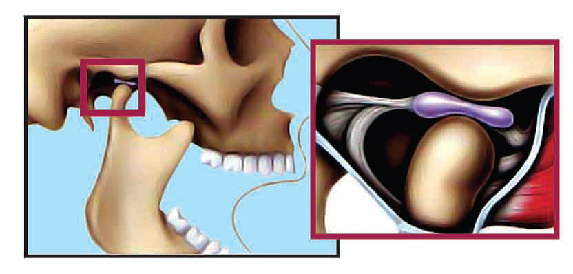 Temporomandibular Joint in Normal Open Position